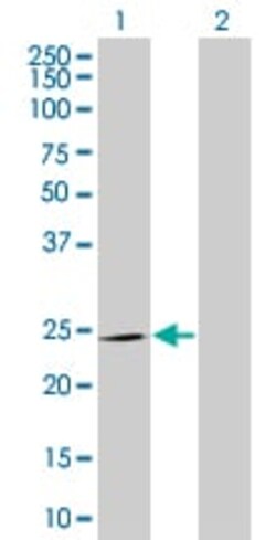Abcam&nbsp;SNAP25 overexpression 293T lysate (whole cell).