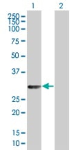 Abcam&nbsp;Galectin 3 overexpression 293T lysate (whole cell).