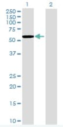 Abcam&nbsp;Fyn overexpression 293T lysate (whole cell).