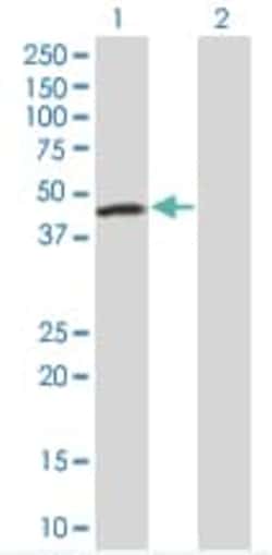 Abcam&nbsp;FEN1 overexpression 293T lysate (whole cell).