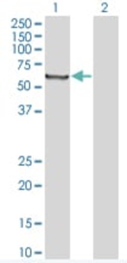Abcam&nbsp;Transglutaminase 2 overexpression 293T lysate (whole cell).