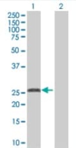 Abcam Alpha 1 Acid Glycoprotein overexpression 293T lysate (whole cell).