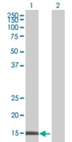 Abcam&nbsp;PBR overexpression 293T lysate (whole cell).