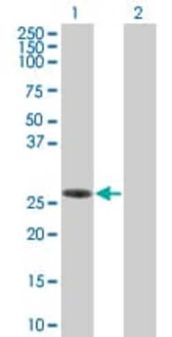 Abcam&nbsp;SLAP2 overexpression 293T lysate (whole cell).