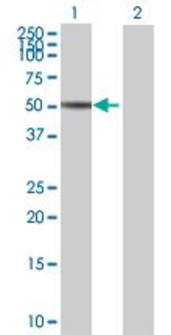 Abcam&nbsp;MST4 overexpression 293T lysate (whole cell).