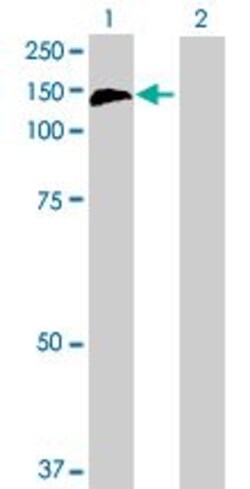 Abcam&nbsp;CBL overexpression 293T lysate (whole cell).
