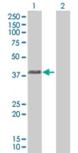 Abcam&nbsp;HLA E overexpression 293T lysate (whole cell).