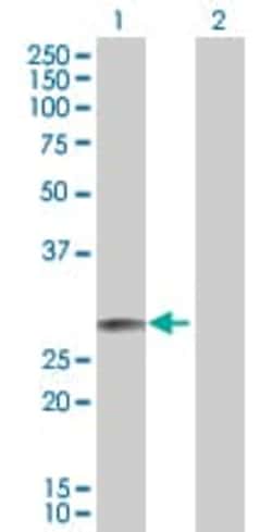 Abcam&nbsp;EPO overexpression 293T lysate (whole cell).