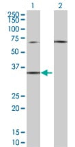 Abcam&nbsp;EDG2 / LPA-1 overexpression 293T lysate (whole cell).