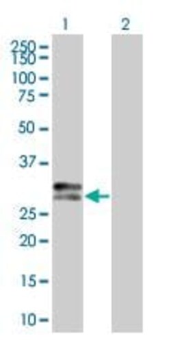 Abcam&nbsp;HLA-DP overexpression 293T lysate (whole cell).