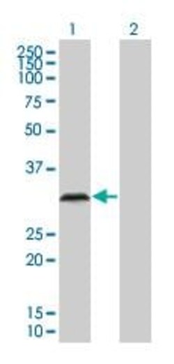 Abcam&nbsp;IGFBP6 overexpression 293T lysate (whole cell).