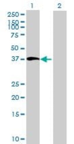 Abcam&nbsp;BMP5 overexpression 293T lysate (whole cell).