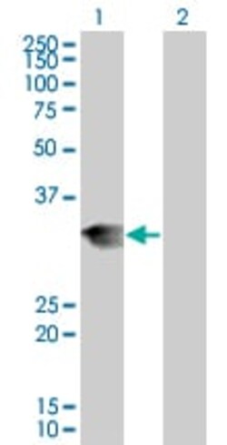 Abcam&nbsp;Lunatic Fringe overexpression 293T lysate (whole cell).