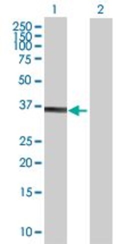 Abcam Annexin-8/ANXA8 overexpression 293T lysate (whole cell).