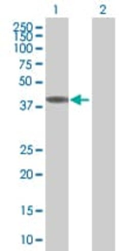 Abcam&nbsp;ANXA7 overexpression 293T lysate (whole cell).