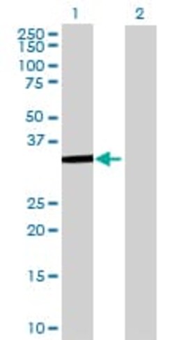 Abcam HDAC7 overexpression 293T lysate (whole cell).