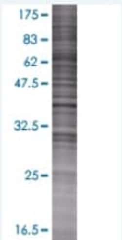 Abcam&nbsp;MTMR1 overexpression 293T lysate (whole cell).