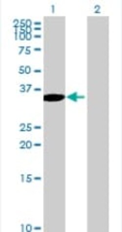 Abcam&nbsp;DOK3 overexpression 293T lysate (whole cell).