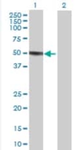 Abcam&nbsp;CHN 1 overexpression 293T lysate (whole cell).