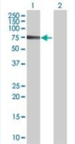 Abcam&nbsp;MTM1 overexpression 293T lysate (whole cell).