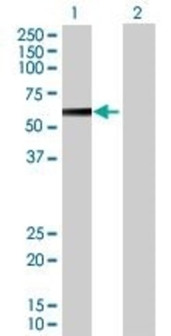 Abcam&nbsp;PPP2R5A overexpression 293T lysate (whole cell).