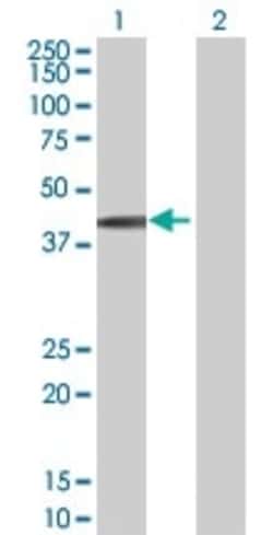 Abcam&nbsp;SPHK1 overexpression 293T lysate (whole cell).