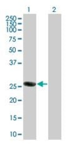 Abcam&nbsp;ORC6L overexpression 293T lysate (whole cell).