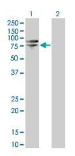 Abcam&nbsp;SNX1 overexpression 293T lysate (whole cell).
