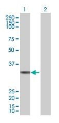 Abcam&nbsp;Thymidylate Synthase overexpression 293T lysate (whole cell).