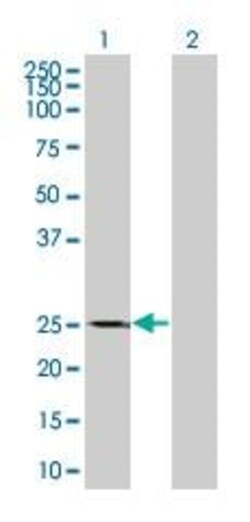 Abcam&nbsp;Thymidine Kinase 1 overexpression 293T lysate (whole cell).