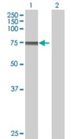 Abcam HCLS1 overexpression 293T lysate (whole cell).