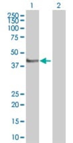 Abcam&nbsp;GAP43 overexpression 293T lysate (whole cell).