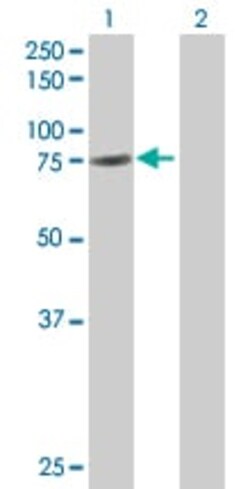 Abcam&nbsp;GAS 6 overexpression 293T lysate (whole cell).