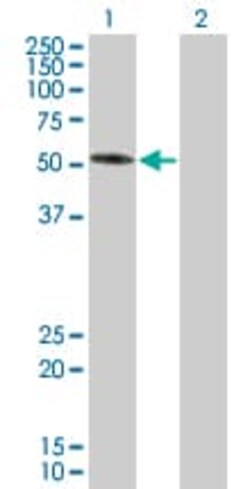 Abcam&nbsp;SH2B1/PSM overexpression 293T lysate (whole cell).