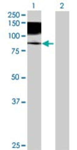 Abcam&nbsp;Axl overexpression 293T lysate (whole cell).