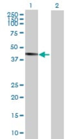 Abcam&nbsp;ZCH11 overexpression 293T lysate (whole cell).