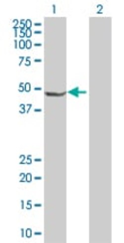 Abcam&nbsp;ORC4L overexpression 293T lysate (whole cell).