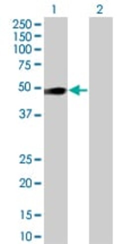 Abcam&nbsp;OSMR overexpression 293T lysate (whole cell).