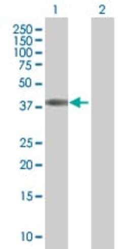 Abcam&nbsp;EpCAM overexpression 293T lysate (whole cell).