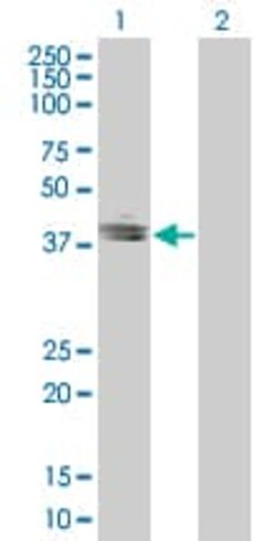 Abcam&nbsp;EpCAM overexpression 293T lysate (whole cell).