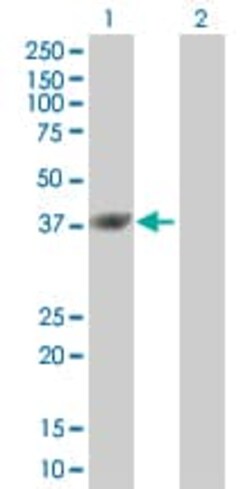 Abcam&nbsp;ICAD overexpression 293T lysate (whole cell).