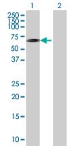 Abcam&nbsp;Hsp60 overexpression 293T lysate (whole cell).