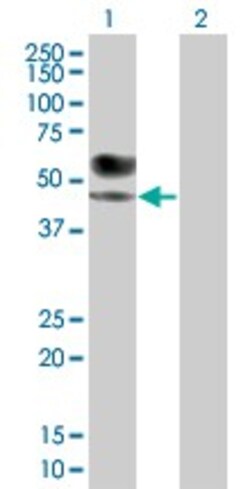 Abcam&nbsp;IL-1-R2 overexpression 293T lysate (whole cell).