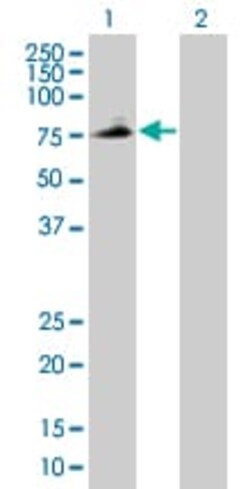 Abcam&nbsp;PLTP overexpression 293T lysate (whole cell).