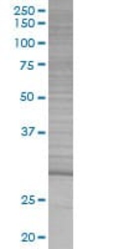 Abcam&nbsp;Dlx1 overexpression 293T lysate (whole cell).