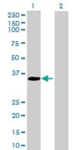 Abcam Neurogenin 2 overexpression 293T lysate (whole cell).