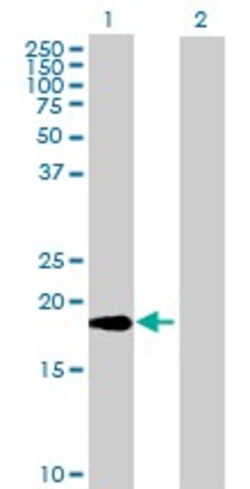 Abcam&nbsp;TWEAK overexpression 293T lysate (whole cell).