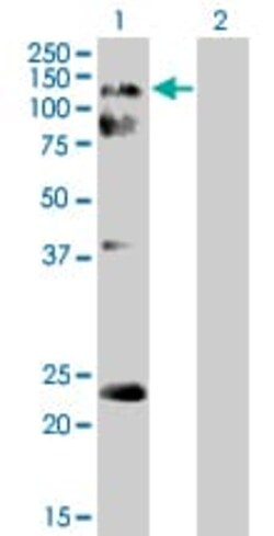 Abcam&nbsp;Eph receptor A2 overexpression 293T lysate (whole cell).