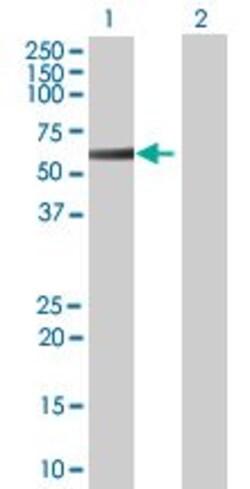 Abcam&nbsp;STK17A overexpression 293T lysate (whole cell).