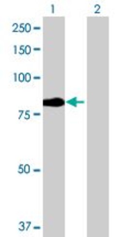 Abcam&nbsp;DR6 overexpression 293T lysate (whole cell).